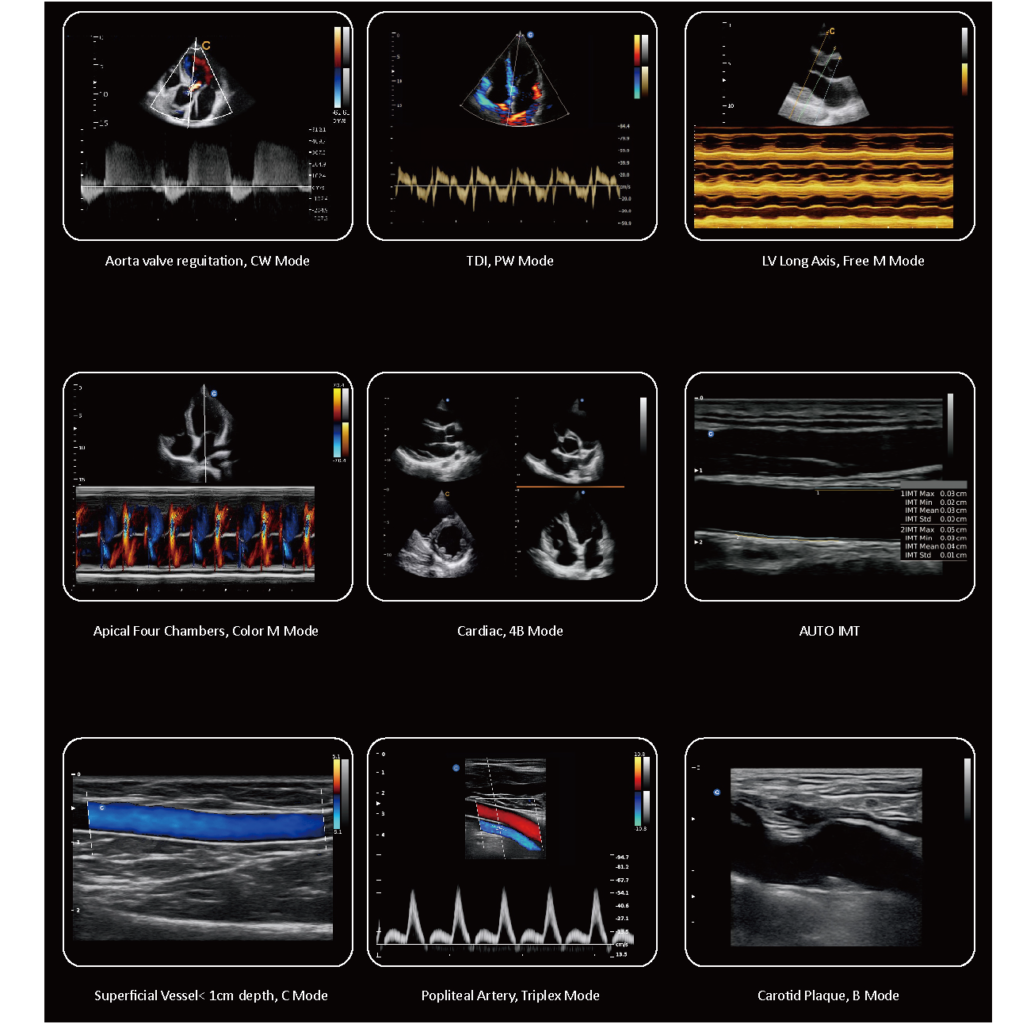 Chison EBit 60 Ultrasound – DJ Medquip